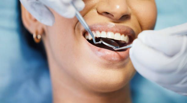 Best Emergency Dental Care for Abscessed Tooth in East Port Orchard, WA